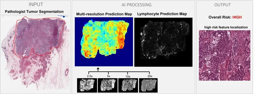 AI-assisted pathology analysis